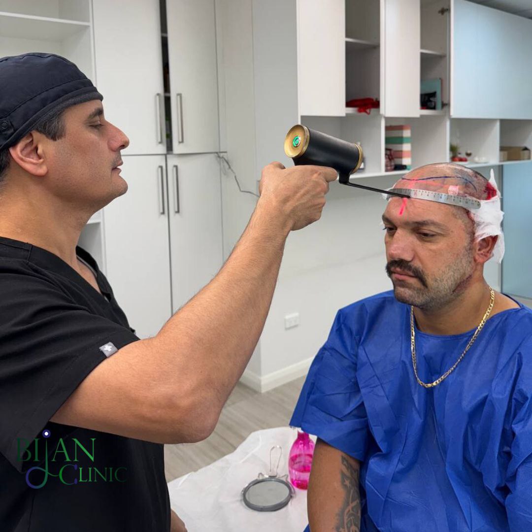 hair transplant australia