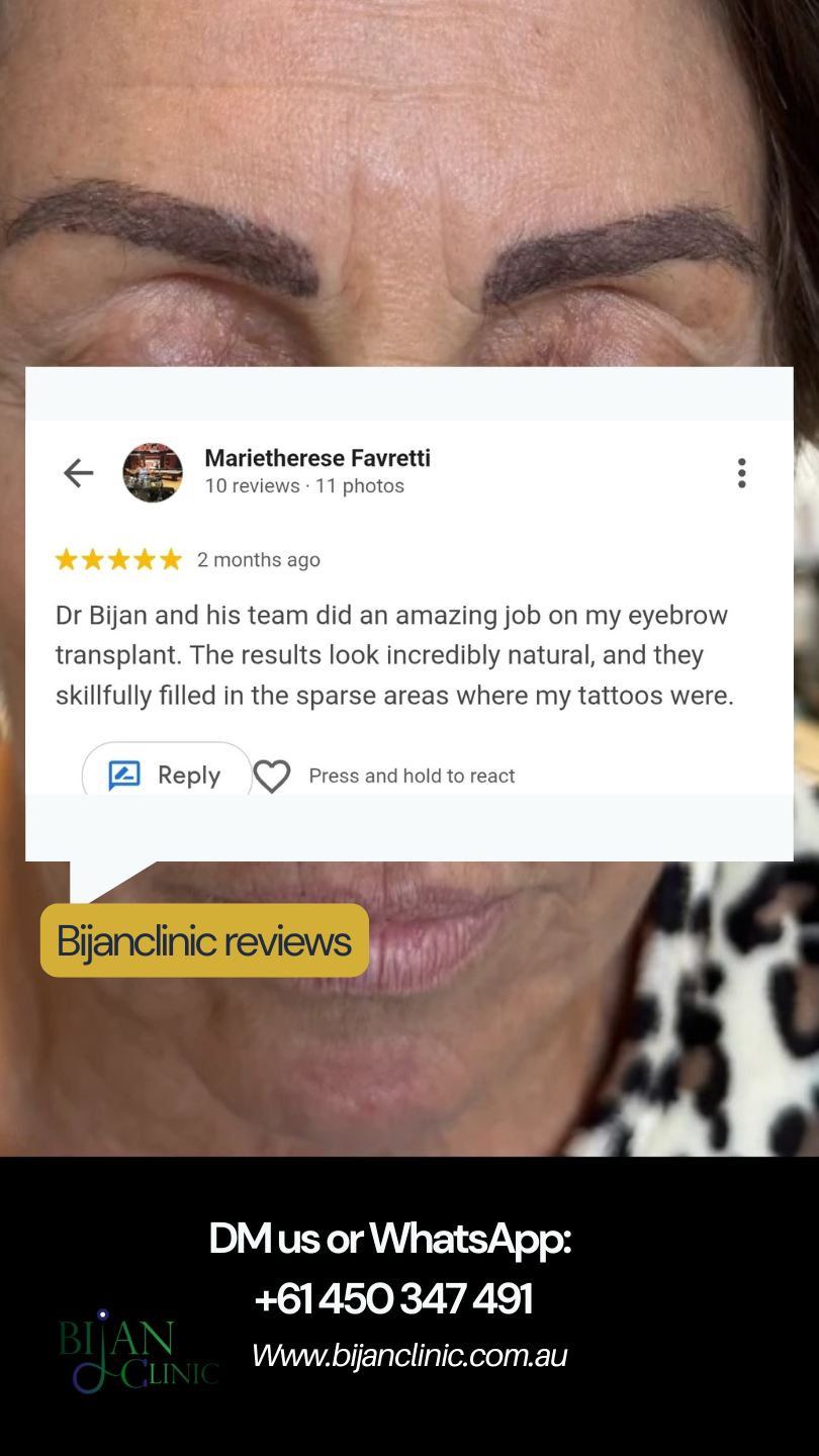 bijanclinic eyebrow reviws