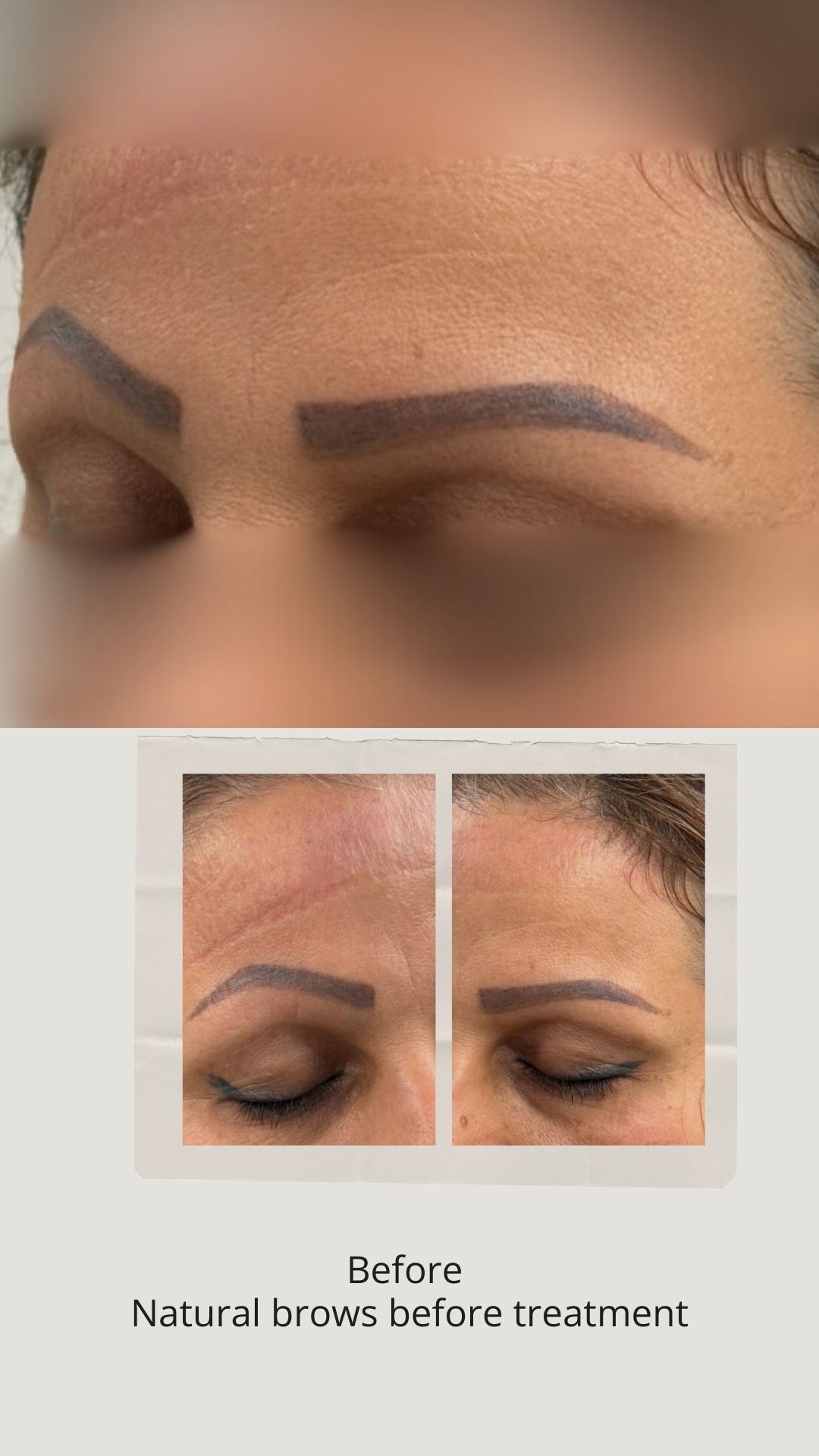 Old eyebrow tattoos frequently become asymmetrical