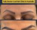 Custom eyebrow transplant correcting asymmetry caused by old eyebrow tattoo