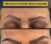 Custom eyebrow transplant correcting asymmetry caused by old eyebrow tattoo