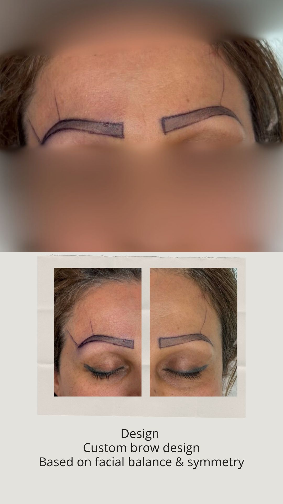 design eyebrow transplant