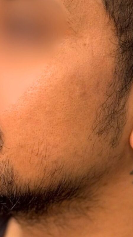 before design beard