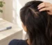 GLP-1 hair loss